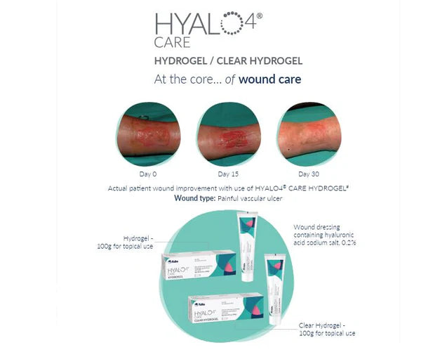 Hyalo4 - Clear Hydrogel
