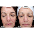 Omnilux Contour FACE: Medical-Grade LED Antiaging Mask