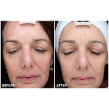 Omnilux Contour FACE: Medical-Grade LED Antiaging Mask