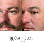 Omnilux MEN: LED Antiaging Mask