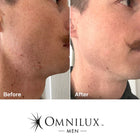 Omnilux MEN: LED Antiaging Mask