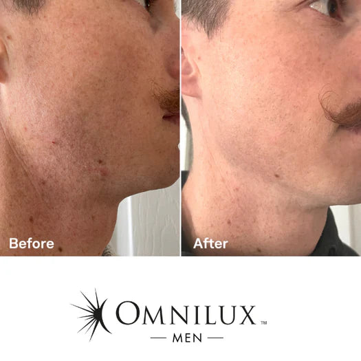 Omnilux MEN: LED Antiaging Mask